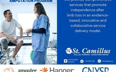 St. Camillus Launches New Amputation Program